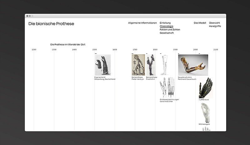 Die bionische Prothese