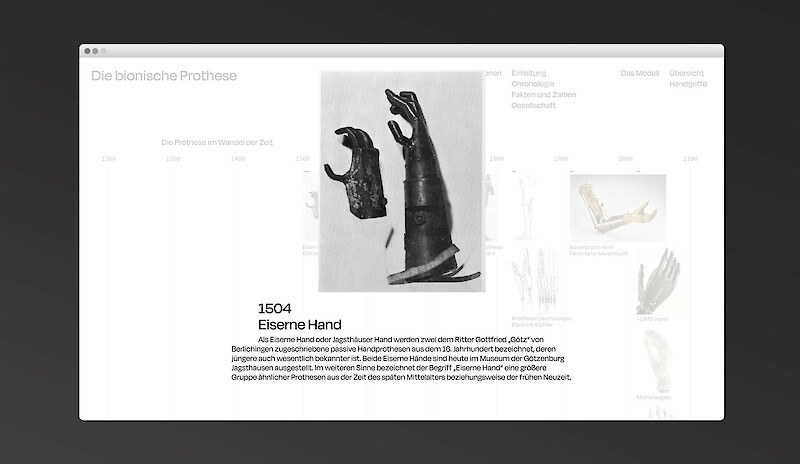 Die bionische Prothese